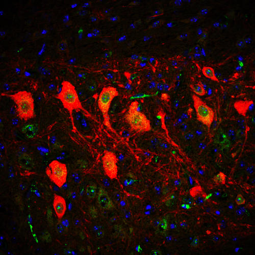 Expression de la protéine SMN (survival of motor neuron) dans les motoneurones de la moelle épinière