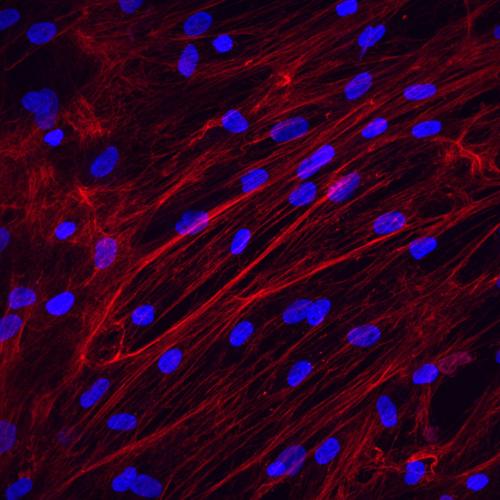 Réseau de fibres de collagène de type I (en rouge) dans des fibroblastes primaires dérivés de peau chez l'homme par immunofluorescence. Noyaux en bleu ©Enzo Cohen
