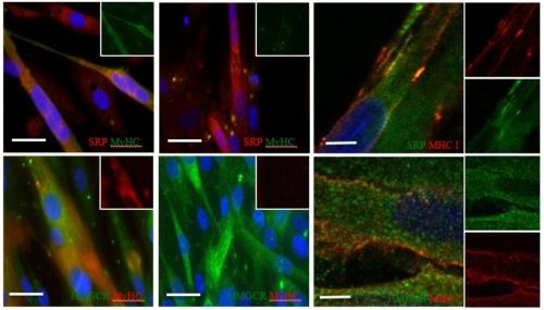In vitro SRP and HMGCR localization in muscle cells: After cell permeabilization, staining for myosin heavy chain (MyHC) or MHC-class I