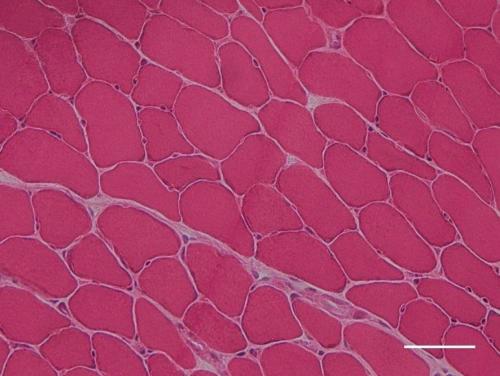 Marquage histologique Hématoxyline-Eosine d’une coupe de muscle de souris. Fibre en rose, noyau en violet (Echelle : 50µm). 