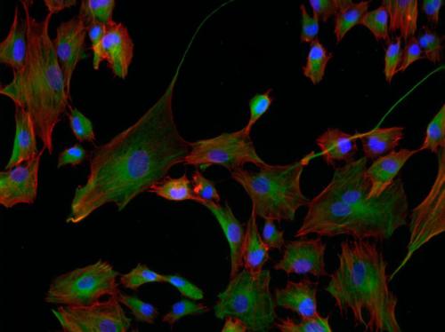 Cellule humaine avec marquage phaloidine (rouge) et vimentine (vert), noyaux en bleu ©équipe3