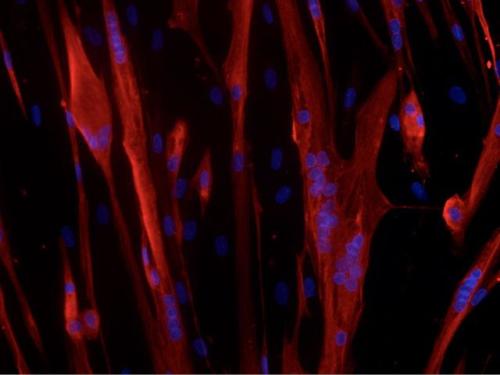 Cellules musculaires en différentiation. En rouge marquage MF20 et en bleu marquage des noyaux   ©DHIAB