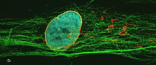 Cellules musculaire en culture, acquise en super résolution. Vert=microtubules, Jaune= Nesprin-1, Rouge = Appareil de Golgi, Bleu= noyau. (B Cadot)