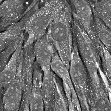 Cellules musculaires en proliferation acquises avec le microscope Nanolive (B Cadot, S Benkhelifa)