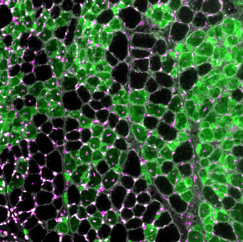 Coupe transversale de muscle de souris. Vert = Myosin embryonnaire, Magenta= noyaux, Blanc = laminine. (C Gentil)