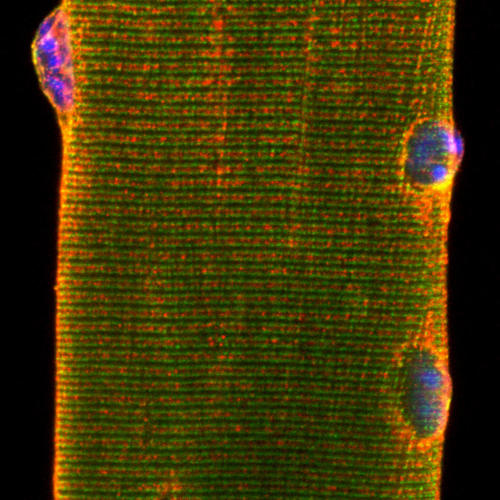 Fibre musculaire marquage DHPR ©France Piétri-Rouxel