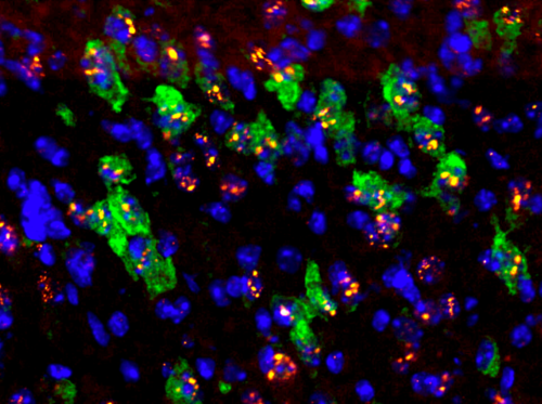 Foci d'ARN DMPK (rouge) et protéine MBNL2 (vert) dans le cerveau de souris DM1 nouveau-née. Les noyaux cellulaires sont colorés en bleu
