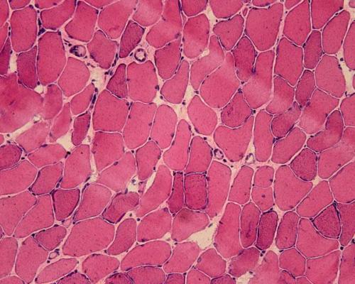 Marquage hématoxyline/eosine d’une coupe de muscle de souris. Les fibres sont en rose et les noyaux en violet ©TROLLET