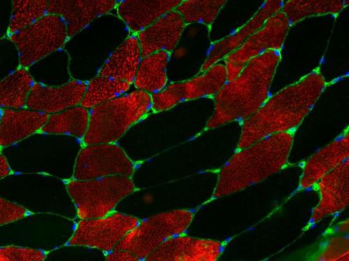 Fibres musculaires chez la souris. En rouge marquage de la troponin T3, en vert la laminine et les noyaux en bleu ©TROLLET